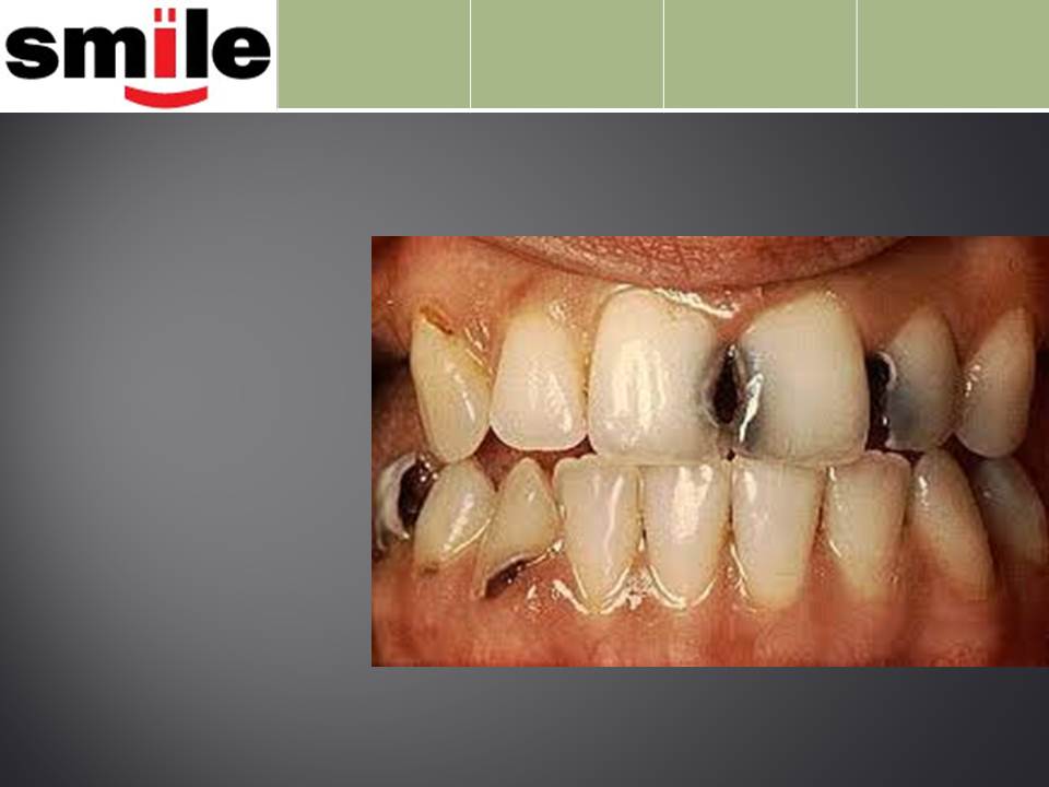 dental amalgam essay dental amalgam essay