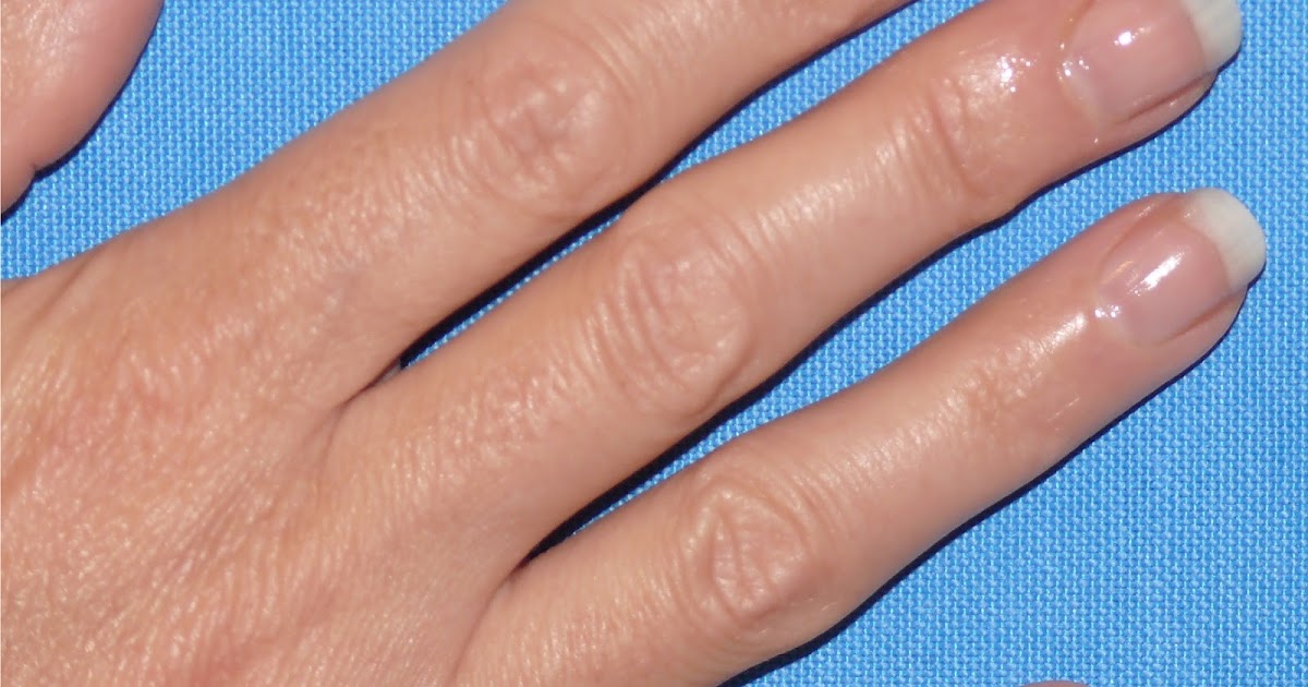Beauty Blog by Lisa TIPS from head to toe! Are yellowing finger
