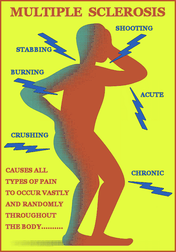welcome to suddenly multiple sclerosis