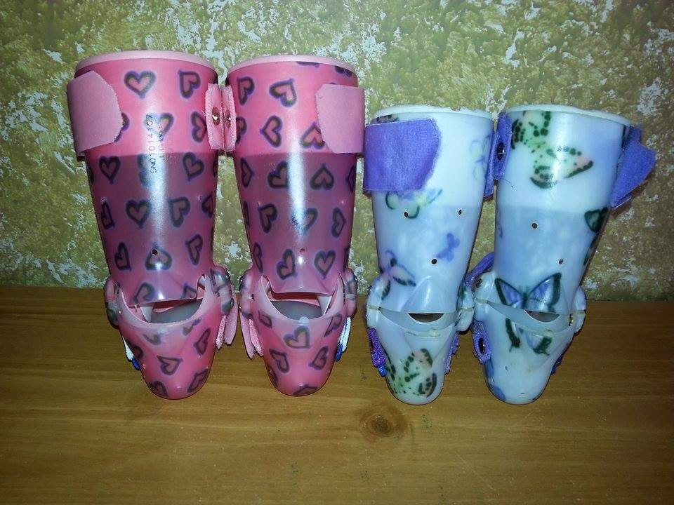 Jumping Julia Kate New AFO's (foot braces)