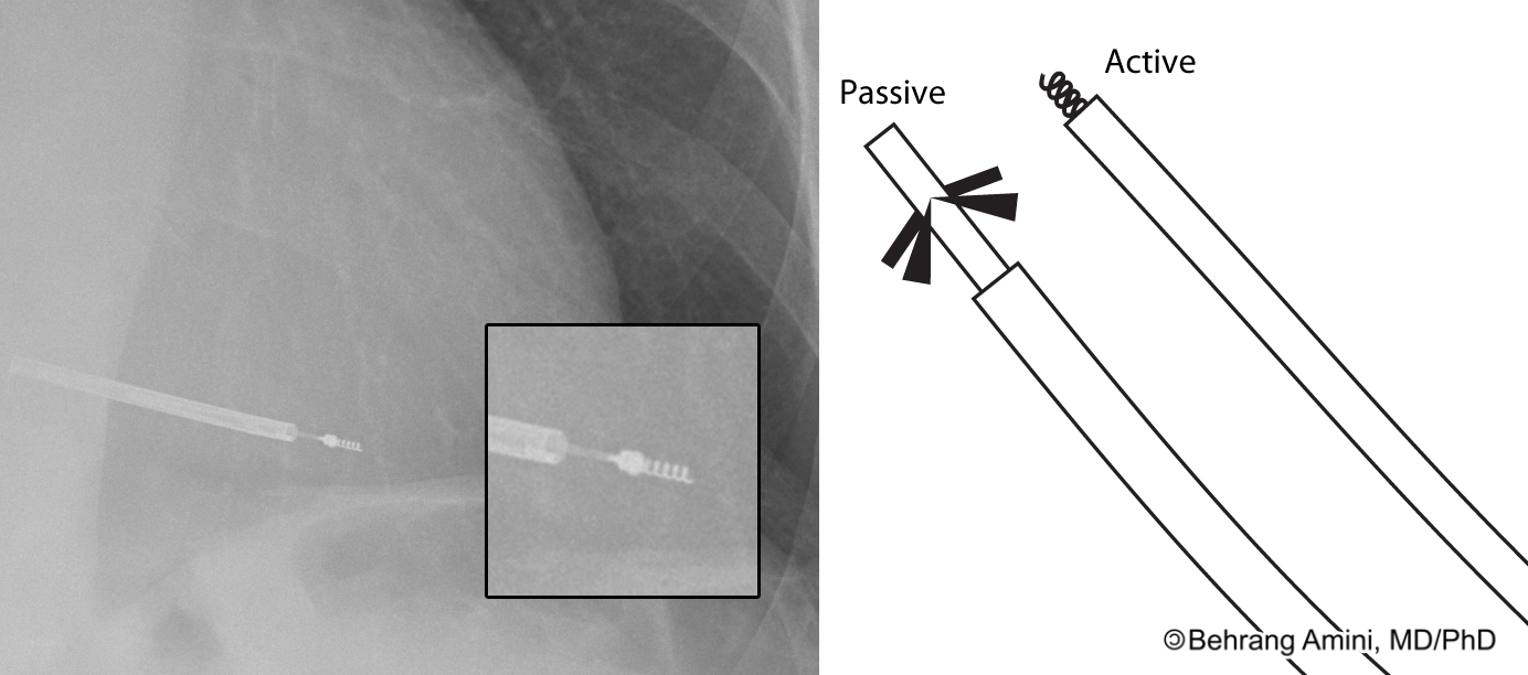 Roentgen Ray Reader February 2012