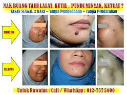 RAWATAN MEMBUANG TAHI LALAT
