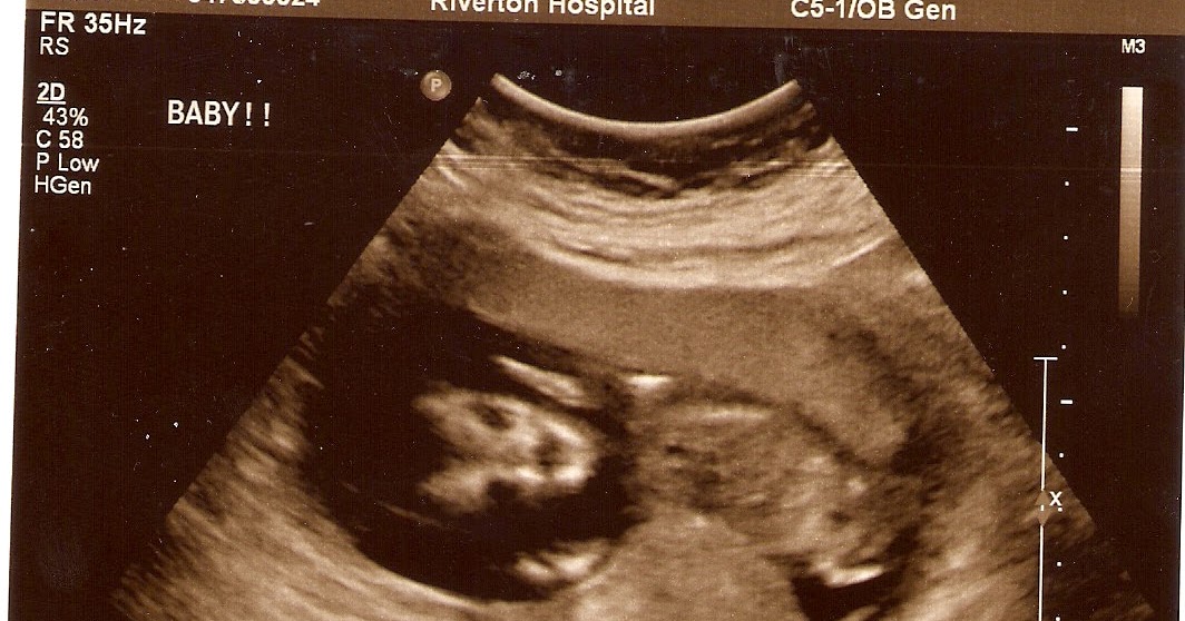 A Journey to Pregnancy and Dealing with PCOS Ultrasound