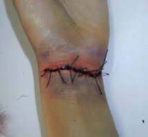 Efeito sutura