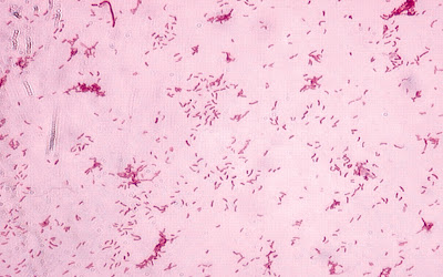 oxidase negative gram negative rods oxidase negative gram negative rods