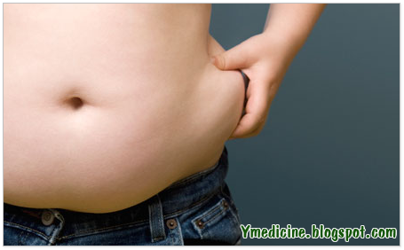 Obesity and infertility in men Obesity and infertility in men