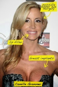 Camille grammer tits