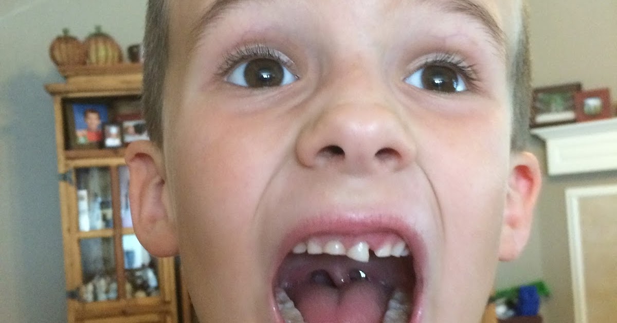 a DAY in the life Wiggly tooth...Stubborn tooth...