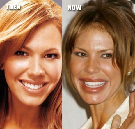 nikki-cox-surgery_lips.jpg