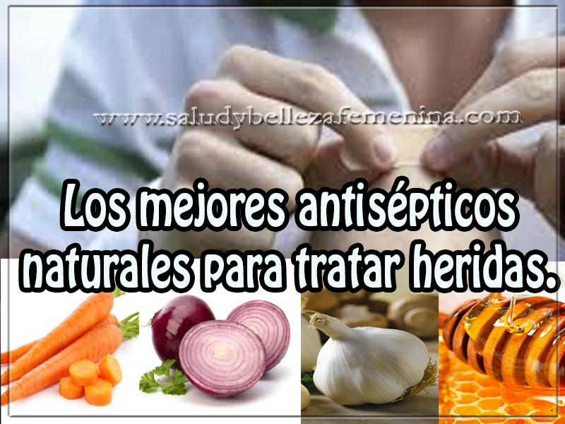 Los mejores antisépticos naturales para tratar heridas. Salud y bienestar , los mejores antisépticos naturales para tratar heridas.
