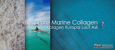 http://4.bp.blogspot.com/-F3sYR4clCvg/UNJ3Eanv6AI/AAAAAAAAAaw/b137vB1q46I/s1600/PMC_PureMarineCollagen_Banner_01.gif