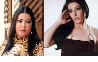 صور الفنانات قبل وبعد عمليات التجميل صور الفنانات قبل وبعد عمليات التجميل