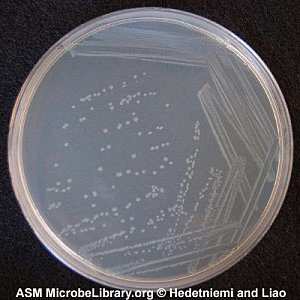 research manuscript on proteus vulgaris research manuscript on proteus vulgaris