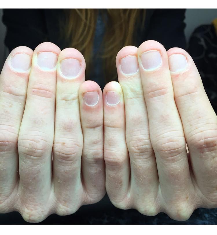 Bethel Coleman Nail Artist Nail Biters