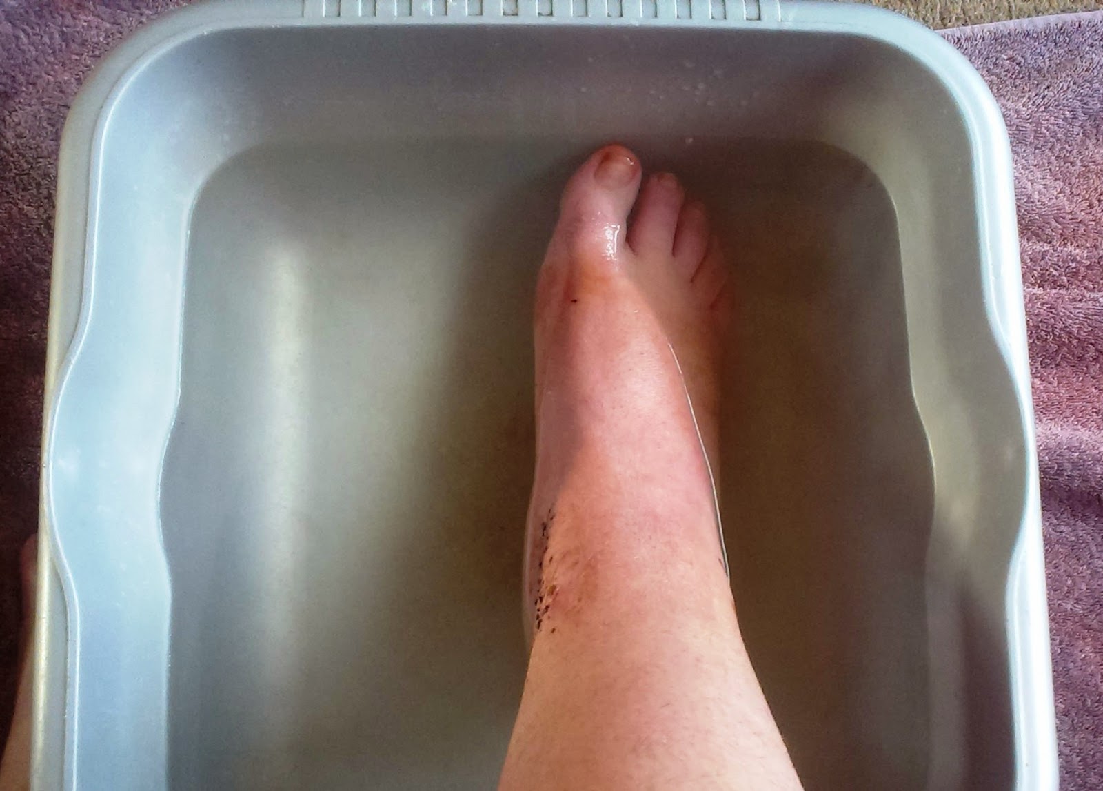 Putting my foot in water after six weeks