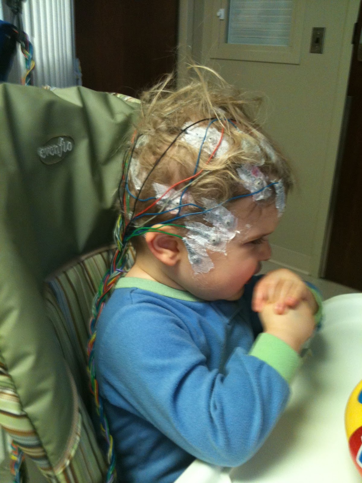 Taking it Day by Day with Developmental Delays/Now Severe Multiple