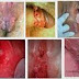 Obat Antibiotik Basmi Turuk Yang Kena Kutil thumbnail