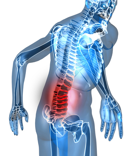Bad Backs