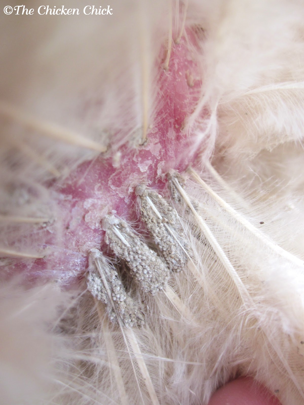 The Hidden Dangers Of Chicken Lice: Humans At Risk? - e7wtxio