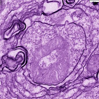 Mitocondria dentro de un autofagosoma durante el proceso de mitofagia. (CSIC)