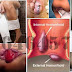 Nama Obat Wasir Paling Ampuh dan Manjur thumbnail