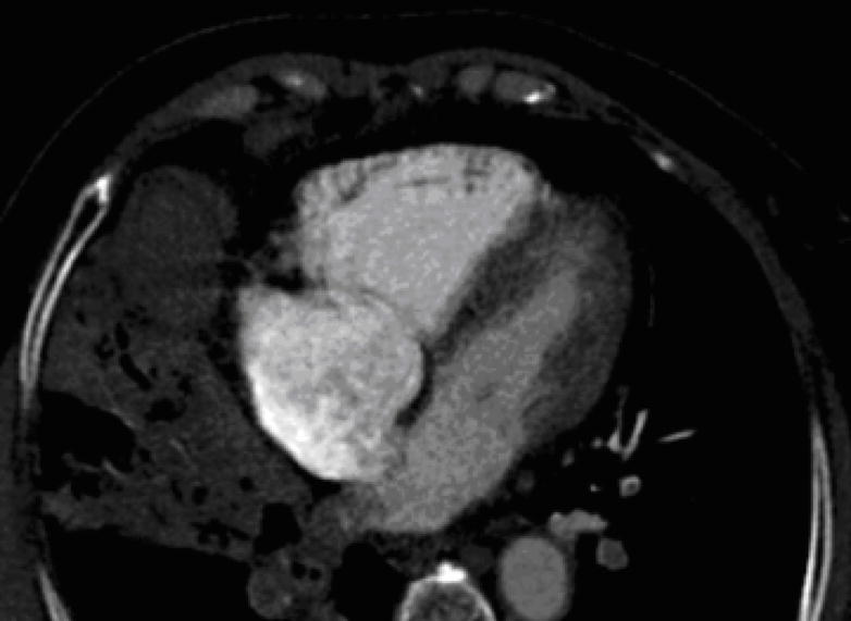 ct scanner axis