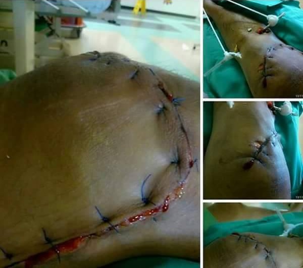 "Kalau Nak Cantik, Hantar Lah Pi Butik Bukan Hospital."! "Kalau Nak Cantik, Hantar Lah Pi Butik Bukan Hospital."!
