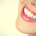 5 أشياء طبيعية من أجل أسنان ناصعة البياض 