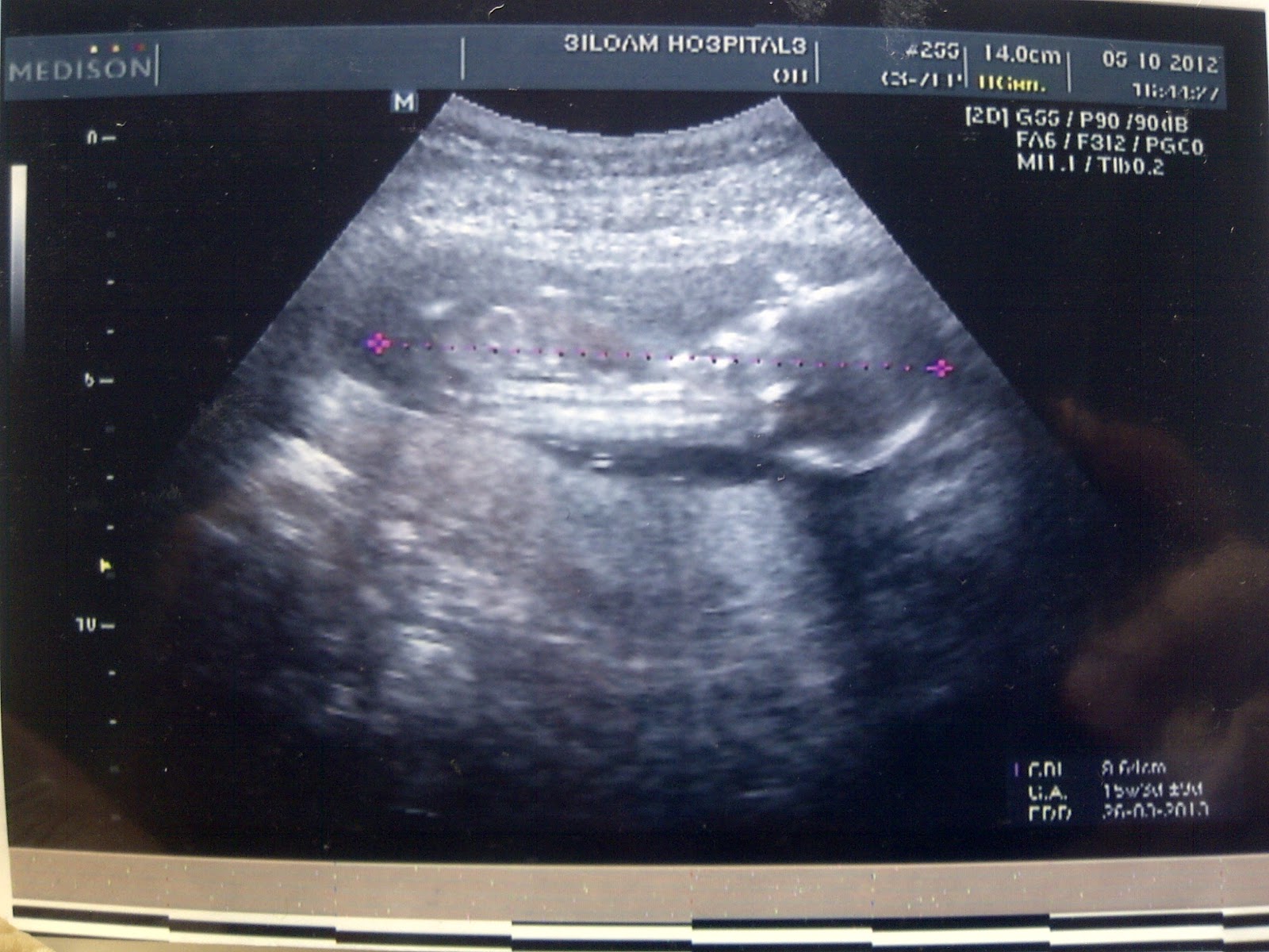 my miracle pregnancy saat saat kontrol my miracle pregnancy saat saat kontrol