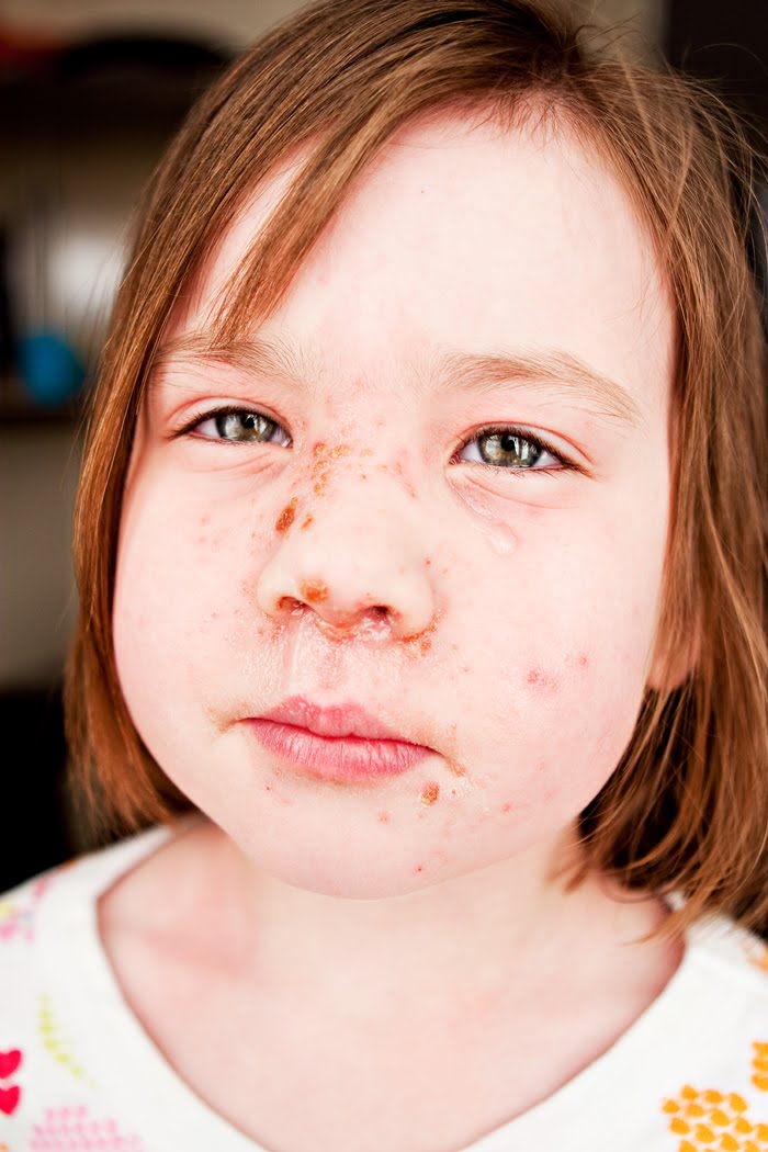 Happenings at Home Strep Face