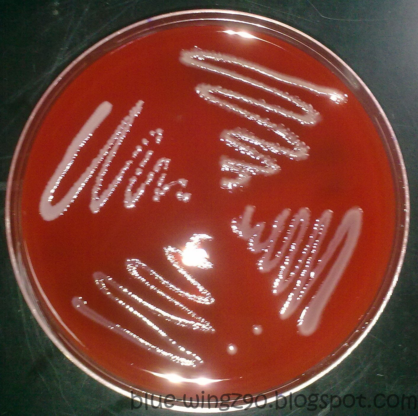 on mannitol salt agar.