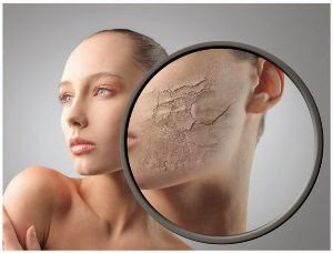Tips Mengatasi Kulit Muka Yang Kering