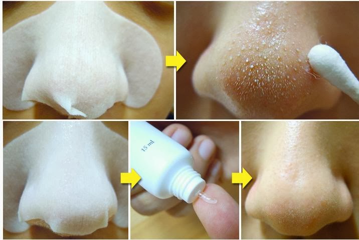 how to reduce pore size try out this skinmiso pore pact lady fox how to reduce pore size on nose