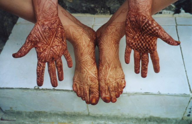 henna tattoo allergic reaction 7 is left with chemical henna tattoo allergic reaction 7 is left with chemical