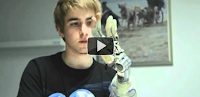 protesis de mano robotica
