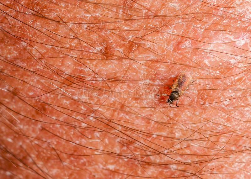 best homemade gnat traps and gnat bites guide do gnats bite