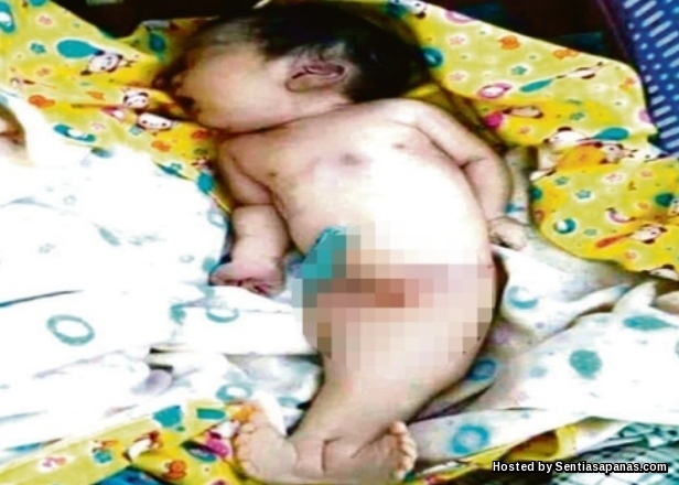 Gambar Bayi Duyung Di Hospital Pontian Bayi-duyung