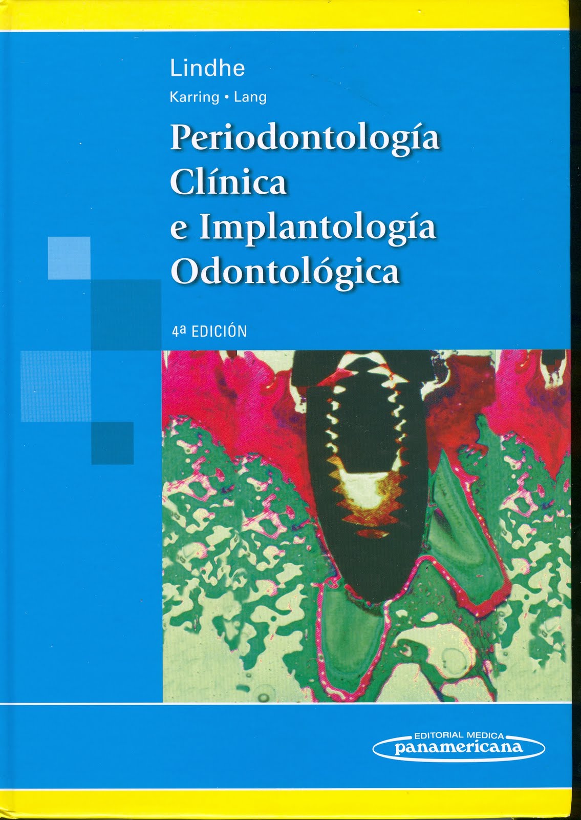 Periodontologia Clinica Carranza 10 Edicion Pdf Free
