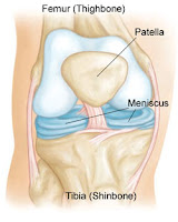 Diagram of the knee with highlight of the meniscus