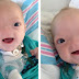 Baby Born Without Nose Is Very Cute