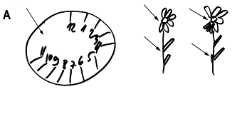 Example of "neglect syndrom"
