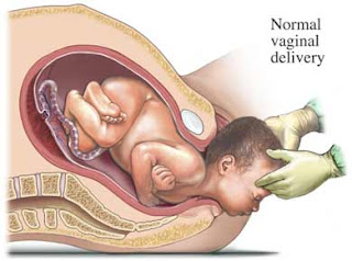 GRADO MADURACION PLACENTA EMBARAZO grado maduracion placenta embarazo: