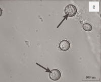 http://sciencythoughts.blogspot.co.uk/2015/02/free-living-amoebae-in-water-system-of.html