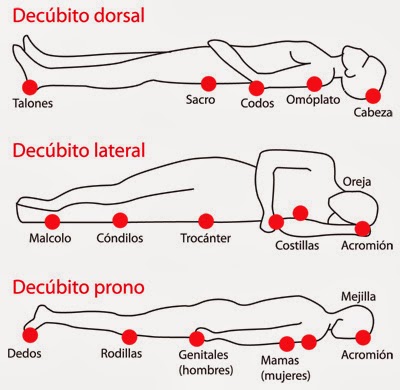Ulceras Por Estres Pdf