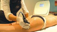 cellulite reduction therapy review