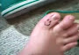 Little Toe