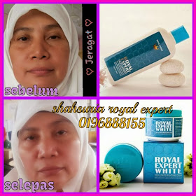 Promosi Royal Expert White Malaysia Original Royal Expert White Testimoni 11