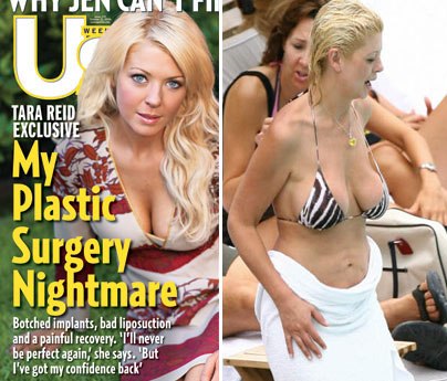 Talk Tara reids botched boob Tara reids botched boob