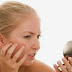 Tips to Get Rid of Facial Scars