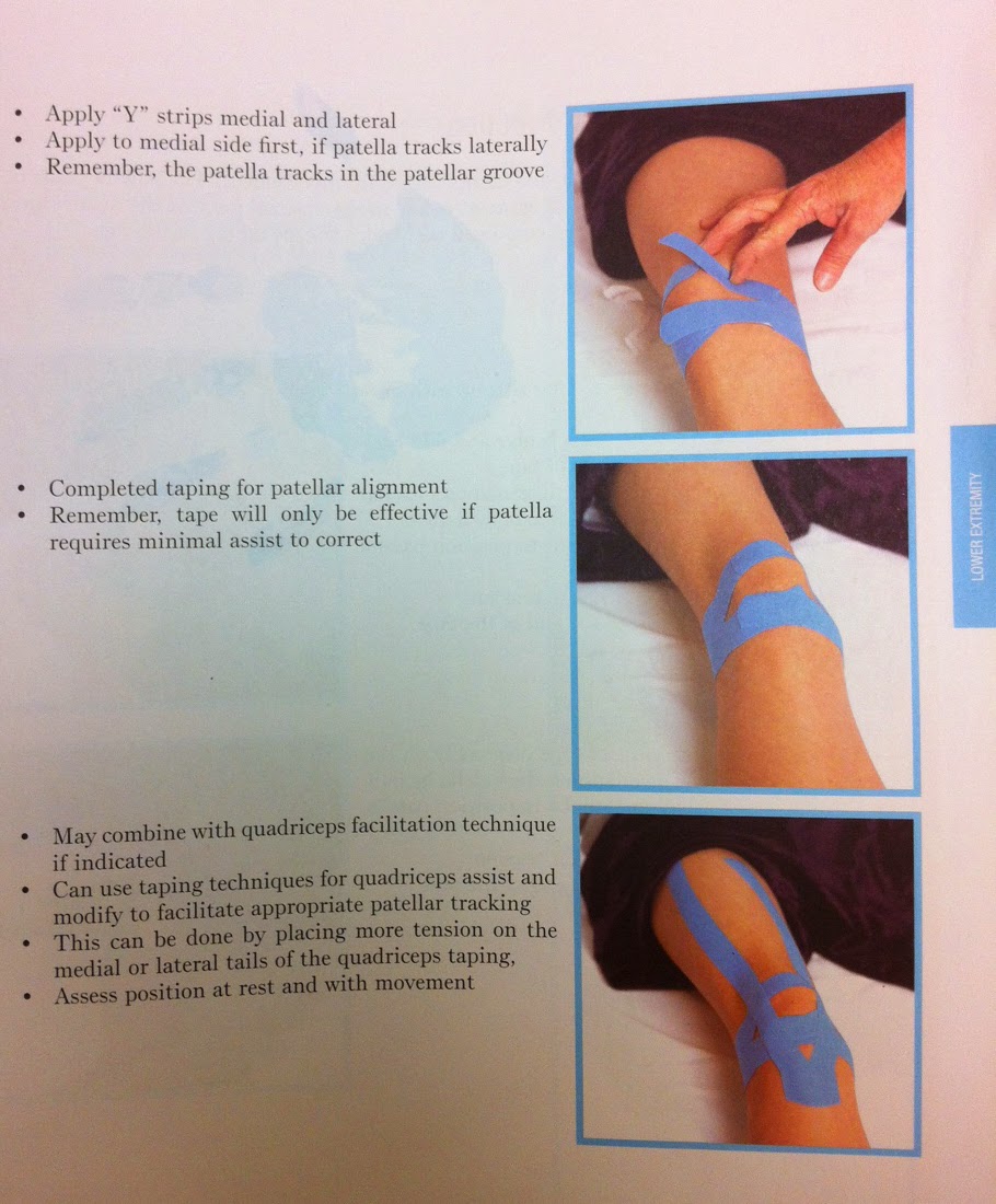 Ehlers Danlos Syndrome Here Taping knees for support Ehlers Danlos